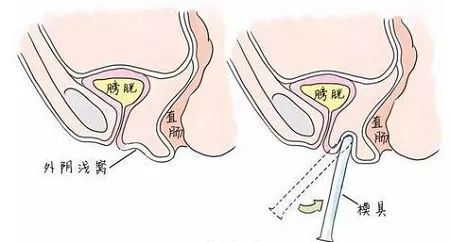 命运之轮揭秘，阴生子的最新章节揭晓